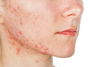 �в�ҩ��Ĥ����۷� ��ൽλ�ܰ��㻤������