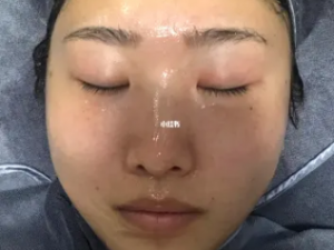 ʳ��Сƫ���Գ��⻬���� ���ϵİ߰ߵ�㲻�ٳ���