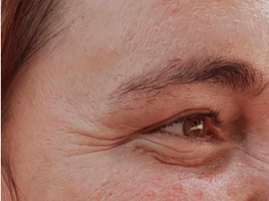 ȱˮ������ë�״ִ��� ë�״ִ�Ӧ����ô�޸�