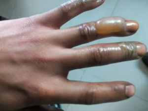 ����������� ��ҽ����Щ����ƫ��