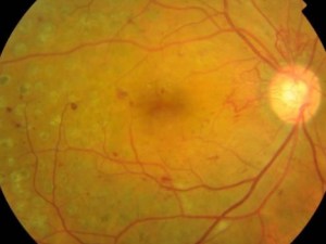 ����������������������Ĥ�ư߲��� �Լ�������Ԥ���ư߲���