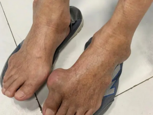 ʹ����һ�����߼��� �������Ч����