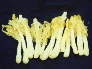 ��ݥ�Ĵ�Ӫ����ֵ