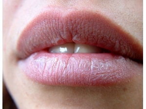 ����Ƥ��������ˮ��Ƥ����ˮ��������