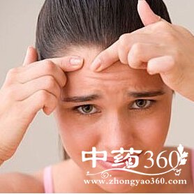 青春期如何祛痘,青春期的烦恼祛痘小绝招