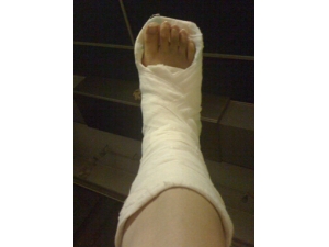 ��Ť������ô�� ��ҽ�������ƽ�Ť��