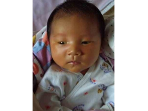 育儿知识大全 婴幼儿七种皮肤现象