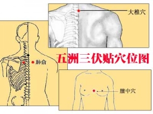 ������������Ѩλͼ