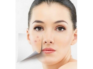 ��������Ƥ�� ��֢Ԥ������Ƥ��С����