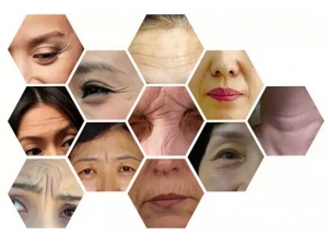 ȫ��λȥ���沿���� �������ἡ��