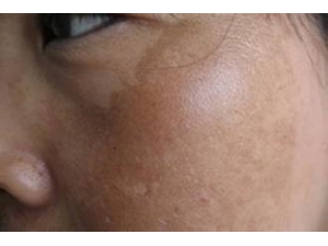 �ƺְ�ʳ�Ƶ�����ȫ������