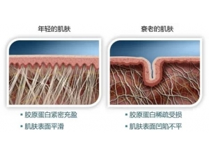 ���أ�����Ƥ��˥�ϵ���������