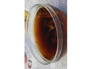 ��ĸ�ݵ���������Ѫ���� ��ĸ�ݵ�������ô��