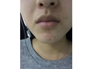 ȥ������Ч���� ϴ��ˮ�̫������