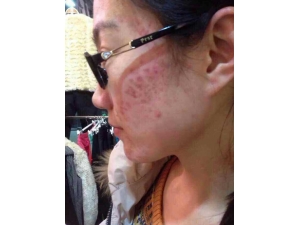 ��ӡ��ʲô ȥ����ӡ�ķ���