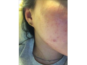 ������ӡ����Ч���� ˿�Ͻ�Ƭ������