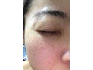 ����ȥ���۽ǵ����� ���㼸��������Ĥ���巽��