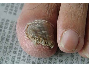 ���ƫ��֮�´��ݴ������ƻ�ָ��