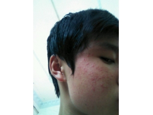 ��ҽȥ�۴� ���������㲻�ò�ѡ��