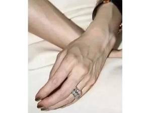 青筋凸起到底是什么原因?