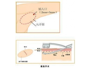 ��ô���Դ�ȥ���� ������ƺ���Сƫ��