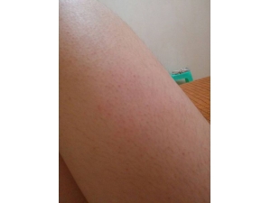 ��ҽ����ë��С���� �����м�ʵ������Ч