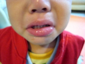 ���ƿ�ǻ�������ҩ