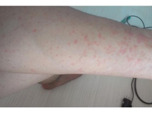 ʪ���Щʲôʳ��������� 3�����ʳ���ǿ���