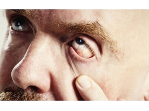 ��Ⱦ�Ժ��۲��Ĵ���;�� ��ҽƫ�����ƴ�Ⱦ�Ժ��۲�