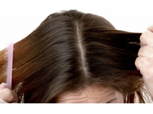 ͷƤм������ճ�����  ����ͷƤм��Сƫ��