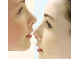 ɫӰֵ һЩʵּ򵥵Сƫ