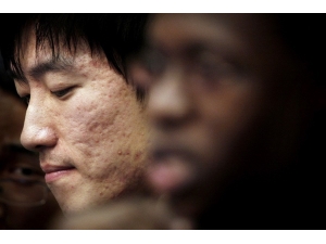 �ഺ���沿Ѩλ��Ħ������