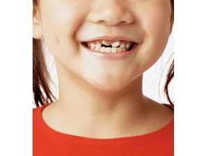 ʲô���������� �������Զ�ͯ����ЩӰ��