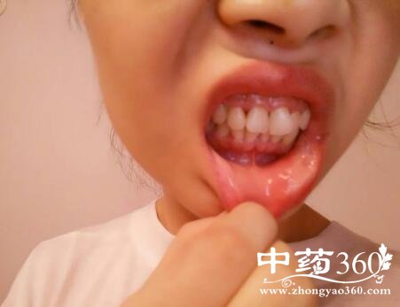 �峿�����촽��������ô�죿