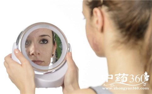 不同位置长痘痘的原因 如何快速祛痘 祛痘有哪些方法