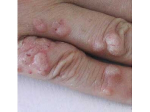 ��ҽ�ڵ������������ζ����ļ��� ��һ��Ҫ֪��Ŷ