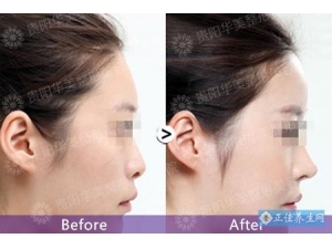 ����¡�����ξ�����ʲô��