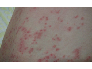 ���ʪ������ô���� ��ҽ���Ԥ��