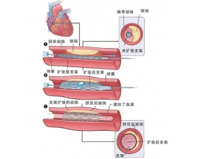 �ļ�ȱѪ�ɿ� ��ʳ����