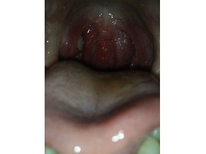 �����巢��զ�� �������а������ɽ��