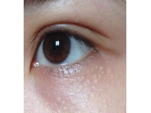 �۲�Ϊʲô�᳤֬���� �������۲�֬����