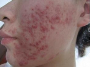 ����� ��ҽ���Ч����