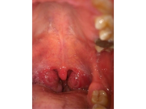 �⵼�巢������ô�� �����巢�׶����Щ�кô�