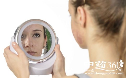 为什么会长痘 如何祛除青春痘 长痘如何护理