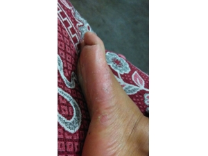 ������ô���� ����ݽ�ƫ������Ч����