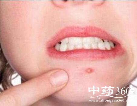 ���ܱ߳�����ʲôԭ��