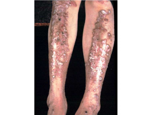 ְҵ��Ƥ������ʲô ��ô�����Ʋ���Ч��