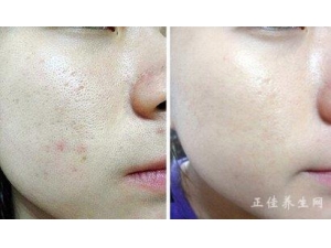 ���������������ë��