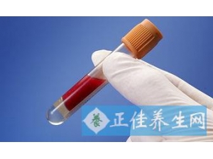 Ѫ֬Ϊʲô��� Ѫ֬�ߵ�Σ��