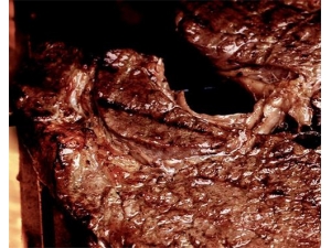 ¿�޵Ĺ�Ч������ ������Ѫ��Ч��